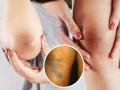 Skin Whitening Knee and Elbow : चेहरा गोरा अन् कोपर, मान, गुडघे काळे दिसतात? स्किन एक्सपर्ट्सनी सांगितले काळपटपणा दूर करण्याचे उपाय - Marathi News | Skin Whitening Knee and Elbow : Blonde face, elbows, neck, knees look black? Skin experts say the solution to eliminate blackheads | Latest sakhi News at Lokmat.com