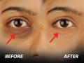 How To Remove Dark Circles : डार्क सर्कल्समुळे चेहरा ग्लोईंग दिसत नाहीये? 'या' उपायांनी झटपट दूर होईल डोळ्यांखालचा काळपटपणा - Marathi News | How To Remove Dark Circles : Home remedies for removal of dark circles | Latest sakhi News at Lokmat.com