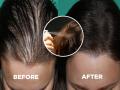 How To Get Long Thick Hair : केस गळून गळून खूप पातळ झालेत? 'या' ट्रिक्सनी मिळवा दाट, लांबसडक केसांचा लूक - Marathi News | How To Get Long Thick Hair : How to make thin hair look thicker instantly | Latest sakhi News at Lokmat.com