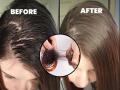 how to get long hair : केस कोरडे तर कधी जास्त चिपचिपे दिसतात? चमकदार, लांबसडक केसांसाठी हे घ्या ३ सोपे उपाय  - Marathi News | how to get shiny long hair : Diy hair care tips to improve hair shine with home remedies | Latest sakhi News at Lokmat.com