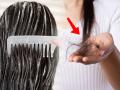 How to Stop Hair Fall : खरंच कंडिशनर लावल्यानं केस खूप गळतात? काय आहे तथ्य, लावण्याची योग्य पद्धत कोणती? वाचा - Marathi News | How to Stop Hair Fall : Conditioner is good or bad for hair fack check | Latest sakhi News at Lokmat.com