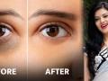 How to remove dark circles : डार्क सर्कल्समुळे चेहरा थकल्यासारखा, वयस्कर वाटतोय? टवटवीत, ग्लोईंग त्वचेसाठी हे घ्या उपाय - Marathi News | How to remove dark circles : Remove dark circles under eyes with these 10 easy home remedies | Latest sakhi Photos at Lokmat.com