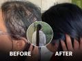 How to grow long hair : केसांचा झाडू झालाय? शॅम्पू बदलूनही गळणं थांबत नाहीये? दाट, काळ्याभोर केसांसाठी 'हा' घ्या घरगुती हेअर मास्क - Marathi News | How to grow long hair : According to doctor this ayurvedic hair mask is best to keep your hair black and shiny | Latest sakhi News at Lokmat.com