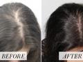 Tips for long, thick hairs : फिटनेस एक्सपर्ट यास्मीन कराचीवालानं सांगितले केसांची गळती थांबवण्याचे उपाय; जाणून घ्या कारणं - Marathi News | Tips for long, thick hairs : Yasmin karachiwala that adding oil does not cause hair growth these factors are responsible | Latest sakhi News at Lokmat.com
