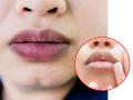 थंडीत ओठ काळवंडले? ४ सोपे उपाय, ओठ होतील मऊ- मुलायम- गुलाबी - Marathi News | Beauty tips: Home remedies for making your lips soft, shiny and pink | Latest sakhi News at Lokmat.com