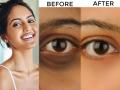 Dark circles under eyes : डार्क सर्कल्समुळे चेहरा थकल्यासारखा, वयस्कर वाटतोय? 'या' उपायांनी चुटकीसरशी मिळेल काळेपणापासून सुटका - Marathi News | Dark circles under eyes : How to conceal your dark circle with easy makeup tips | Latest sakhi News at Lokmat.com