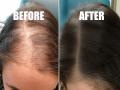 Hair Care tips : कंगवा फिरवताच खूप केस हातात येतात? दाट, लांबसडक केसांसाठी वापरा हा खास हेअर मास्क - Marathi News | Hair Care tips : Do you get a lot of hair when you turn the comb? Use this special hair mask for thick, long hair | Latest sakhi News at Lokmat.com