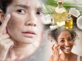 Skin Care Tips : चेहरा खूप थकल्यासारखा, वयस्कर वाटतोय? 'हा' उपाय वापरा, त्वचेचे विकार कायम राहतील लांब - Marathi News | Skin Care Tips : Benefits of Coconut based skin care remedies | Latest sakhi News at Lokmat.com