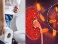 World Kidney Day 2022 : अचानक किडनी खराब होण्यास कारणीभूत ठरतात १० सवयी; आजपासूनच बदला, अन्यथा... - Marathi News | World Kidney Day 2022 : World kidney day 2022 date daily habits that can harm your kidney | Latest sakhi News at Lokmat.com