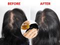 Simple Tips To Boost Hair Growth :  केसांचं गळणं थांबतच नाहीये, शॅम्पूसुद्धा बदलले? ‘हे’ एकच तेल लावा, केस होतील महिनाभरात दाट - Marathi News | Simple Tips To Boost Hair Growth :  Best home remedy for hair growth fast and to regrow hair | Latest sakhi News at Lokmat.com