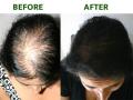 Hair Growth Tips : कंगवा फिरवताच खूप केस तुटतात? दाट, मजबूत केसांसाठी १ उपाय, केसांचं गळणं होईल बंद - Marathi News | Hair Growth Tips : Orange for hair benefits aids dandruff problems also growth | Latest sakhi News at Lokmat.com