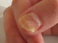 Beauty Tips For Nails: नखांचा पिवळेपणा, नखांत अडकलेली घाण झटकन होईल कमी! घरातल्याच ३ गोष्टी वापरून करा नखं स्वच्छ - Marathi News | | Latest sakhi News at Lokmat.com