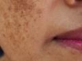 Use Of Sugar For Skin: काळे डाग होतील छुमंतर आणि चेहरा चमकदार! ४ पद्धतीने करा साखरेचा वापर, बघा कमाल ! - Marathi News | | Latest sakhi News at Lokmat.com