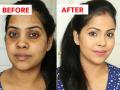 Dark circles solution at home : डार्क सर्कल्समुळे चेहरा खराब झालाय? फक्त १ कप दुध वापरून डार्क सर्कल्सपासून मिळवा सुटका - Marathi News | Dark circles solution at home : How to remove dark circle under eyes milk treatment almonds gulab jal easy tips | Latest sakhi News at Lokmat.com