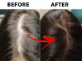 Hair Fall Control Tips : कंगवा फिरवताच खूप केस हातात येतात, कोरडे झालेत; सिल्की, बाऊंसी केसांसाठी ५ आयुर्वेदीक उपाय - Marathi News | Hair Fall Control Tips : Ayurvedic expert shares hair care tips to stop summer hair fallHair Fall Control Tips :  Ayurvedic expert shares hair care tips to stop summer hair fall | Latest sakhi News at Lokmat.com