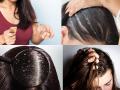 Hair Care: सर्वांनाच सतावणाऱ्या केसांच्या ४ कॉमन समस्या, त्यावर ४ परफेक्ट उपाय.. कम्प्लिट पॅकेज  - Marathi News | Hair Care: 4 Common Hair Problems, 4 Perfect Remedies .. Complete Package for your hair problems | Latest sakhi News at Lokmat.com