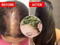 How Grow Hair Very Fast : केस खूपच पातळ झालेत, टक्कल पडण्याची भिती वाटतेय? दाट, लांब केसांसाठी करा ४ उपाय - Marathi News | How Grow Hair Very Fast : Hair fall baldness remedies treatment cure fenugreek onion juice amla aloevera gooseberry | Latest sakhi News at Lokmat.com
