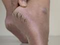 Solutions For Cracked Heels: उष्णतेमुळे तळपायाची आग होते, भेगा पडल्या, रखरखीत झाले? करा 4 उपाय, त्रास होईल कमी - Marathi News | | Latest sakhi News at Lokmat.com