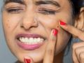 Skin Care With Kesar: पिंपल्स आणि डाग होतील गायब - चेहरा होईल स्वच्छ, केशराच्या काडीची पाहा जादू.. - Marathi News | | Latest sakhi News at Lokmat.com