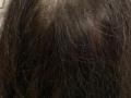 Hair Growth Tips : केस खूप गळताहेत, टक्कल पडण्याची भिती वाटते? ४ उपाय दाट, मजबूत केस राहतील कायम - Marathi News | Hair Growth Tips : 5 Herbs that can boost hair growth | Latest sakhi News at Lokmat.com