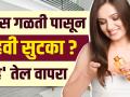 केस गळतीवर घरगुती उपाय | How To Get Rid Of Hair Fall | How to Stop Hair Fall | Hair Care Treatment - Marathi News | Home Remedies for Hair Loss | How To Get Rid Of Hair Fall | How to Stop Hair Fall | Hair Care Treatment | Latest health Videos at Lokmat.com