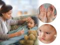 Hand Foot and Mouth Symptoms : पावासाळ्यात मुलं तापानं फणफणली, अंगावर पुरळ? मंकीपॉक्स म्हणून घाबरू नका, वाचा डॉक्टरांचा सल्ला.... - Marathi News | Hand Foot and Mouth Symptoms : hand foot and mouth precautions hand foot and mouth disease vs monkeypox | Latest sakhi News at Lokmat.com
