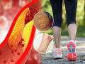 Cholesterol Symptoms : कोलेस्टेरॉल वाढल्याचं सांगतो चालताना पायांमध्ये दिसणारा हा बदल; समजून घ्या लक्षणं - Marathi News | Cholesterol Symptoms : Increasing level of bad ldl cholesterol in your body can be seen in legs | Latest sakhi News at Lokmat.com