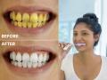 How to Get White Teeth Naturally : पिवळे पडलेले दात दिसतील पांढरेशुभ्र, करा ८ घरगुती उपाय- दातांच्या दुखण्यावर खर्च होणारे हजारो रुपये वाचवा.. - Marathi News | How to Get White Teeth Naturally : 8 simple & home remedies to remove tartar and make your teeth white and strong | Latest sakhi Photos at Lokmat.com