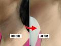 How To Remove Tan From Neck : चेहरा गोरा पण मान जास्तच काळपट दिसते? 5 उपाय, मानेची त्वचा दिसेल ग्लोईंग - Marathi News | How To Remove Tan From Neck : How to get rid of dark neck problem home Remedies for clean neck | Latest sakhi News at Lokmat.com