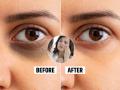 Dark Circles Home Remedy : डार्क सर्कल्समुळे चेहरा खूपच खराब दिसतोय? 6 उपाय, स्किन दिसेल ग्लोईंग, यंग - Marathi News | Dark Circles Home Remedy : Skin care tips some amazing home remedies to get rid of stubborn dark circles | Latest sakhi News at Lokmat.com