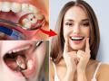 पिवळे दात होतील शुभ्र, चमकदार - करा ३ उपाय घरच्याघरी - Marathi News | Yellow teeth will become white, shiny - Do 3 home remedies | Latest sakhi News at Lokmat.com
