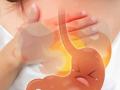 How to cure acid reflux : जेवल्यानंतर छातीत बराचवेळ जळजळ होते? १ उपाय, जळजळ-ॲसिडिटीचा त्रास होईल कमी - Marathi News | How to cure acid reflux heartburn may happen due to your sleeping position after having food meal | Latest sakhi News at Lokmat.com