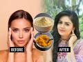 Winter glowing skin tips : चेहरा खूप काळपट, कोरडा पडलाय? ४ उपाय, थंडीतही त्वचा दिसेल मऊ, ग्लोईंग - Marathi News | Winter glowing skin tips : How to get rid of dark skin problem in winter season skin care remedies | Latest sakhi Photos at Lokmat.com