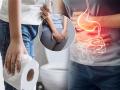 Constipation Relieving Tips : गॅसमुळे पोट साफ व्हायला त्रास होतो? ८ टिप्स, काही सेकंदात दूर होईल गॅस, एसिडीटी - Marathi News | Constipation Relieving Tips : Constipation relieving tips diy home remedies to relieve constipation naturally | Latest sakhi News at Lokmat.com
