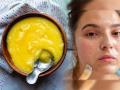 Ghee Benefits for Skin : रात्री फक्त १ चमचा तूप चेहऱ्यावर लावा! तूप लावून येईल रूप, पाहा वापराची योग्य पद्धत - Marathi News | Ghee Benefits for Skin : 3 Best Ways To Use Ghee for Skin | Latest sakhi Photos at Lokmat.com