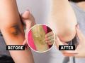 कोपर - गुढघे काळपट पडलेत ? चिंता नको, ३ घरगुती उपाय, दिसेल चमक - Marathi News | Elbows and knees blackened? Don't worry, 3 home remedies will make you glow | Latest sakhi News at Lokmat.com