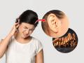 कानावर मुरूम - पुटकुळ्या आल्या आहेत? ३ उपाय, त्रास होईल कमी.. - Marathi News | Got pimples on the ears? 3 solutions, the trouble will be less.. | Latest sakhi News at Lokmat.com