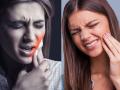 दात दुखत आहेत? ५ घरगुती उपाय, दात वेळेवर सांभाळा नाहीतर.. - Marathi News | Are your teeth hurting? 5 home remedies, take care of your teeth on time or else.. | Latest sakhi News at Lokmat.com