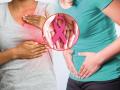 World cancer day : स्त्रियांना होण्याची शक्यता असलेले ५ कॅन्सर, ते कसे टाळता येतील? - Marathi News | World cancer day : 5 cancers that are likely to happen to women, how can they be avoided? | Latest sakhi News at Lokmat.com