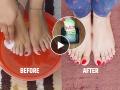 फक्त १० रुपयांत पार्लरसारखं पेडिक्युअर करा घरच्याघरी, पाय दिसतील स्वच्छ होतील मऊ - Marathi News | How to Do A Pedicure : How To Do Pedicure At Home With Natural Ingredients | Latest sakhi News at Lokmat.com