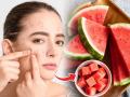 कलिंगड खा आणि उरलेल्या कलिंगडाचे करा ३ फेसपॅक, चेहरा चमकेल आणि उजळेल - Marathi News | Top Watermelon Refreshing Face Packs for the Summers | Latest sakhi News at Lokmat.com