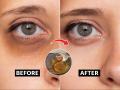 आठवडभरात गायब होतील डोळ्याखालची काळी वर्तुळं, बघा घरगुती आय मास्कची जादू.... - Marathi News | Amazing Eye Masks to Get Rid of Dark Circles and Tired Eyes | Latest sakhi News at Lokmat.com