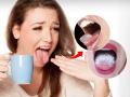 जेवताना जीभ चावली - दाताखाली आली? चटकन करा ५ उपाय - आग होईल कमी... - Marathi News | How To Heal Burnt Tongue 5 Effective Home Remedies | Latest sakhi News at Lokmat.com