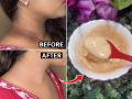 चेहऱ्यापेक्षा मान जास्तच काळी दिसते? १० रूपयांच्या टूथपेस्टची जादू, मान होईल स्वच्छ - Marathi News | How to remove neck tanning : Effective Home Remedies to Remove Tan Using Colgate | Latest sakhi News at Lokmat.com