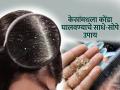 पावसाळ्यात केसांमध्ये कोंडा झाला? ४ टिप्स, केस गळती थांबेल, स्काल्पमधील कोंडा-पुळ्या दूर - Marathi News | Home Remedies to Get Rid of Dandruff Naturally : Dandruff Treatments and Remedies | Latest sakhi Photos at Lokmat.com
