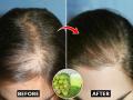 माथ्यावरचे केस पातळ झाले, टक्कल दिसतं? ५ उपाय, केस दिसतील दाट - Marathi News | Natural Remedies to Stop Hair Fall : 5 Tips to Help Your Regrow Hair Naturally | Latest sakhi Photos at Lokmat.com