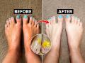 पाय टॅन झालेत? पार्लरसारखं पेडिक्युअर घरी करण्याची १ ट्रिक, मळके पाय दिसतील स्वच्छ आणि सुंदर - Marathi News | How to Remove Tan from Legs Naturally : Effective & Easy Ways on How to Remove Tanning | Latest sakhi News at Lokmat.com