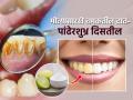दातांवर पिवळा थर आलाय? फक्त २० रूपयांत पांढरेशुभ्र, चमकदार होतील दात, करा २ उपाय - Marathi News | How to Keep Your Teeth Clean : How to Brush Your Teeth Properly Brushing Your Teeth With Baking Soda | Latest sakhi News at Lokmat.com