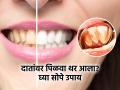 काहीही खाल्लं की दातांवर पिवळा थर येतो? २ मिनिटांत पांढरेशुभ्र दिसतील दात-करा 3 सोपे उपाय - Marathi News | Yellow Teeth Whitening Tips : Tips to Help Keep Your Teeth Clean Between Cleanings | Latest sakhi News at Lokmat.com