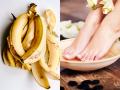 महागडे पेडिक्युअर करायला पार्लरमध्ये जाणं विसरा, केळीच्या सालांनी १० मिनिटांत चमकतील पाय... - Marathi News | how to use banana peels for pedicure, banana peel pedicure the secret to soft smooth feet | Latest sakhi News at Lokmat.com